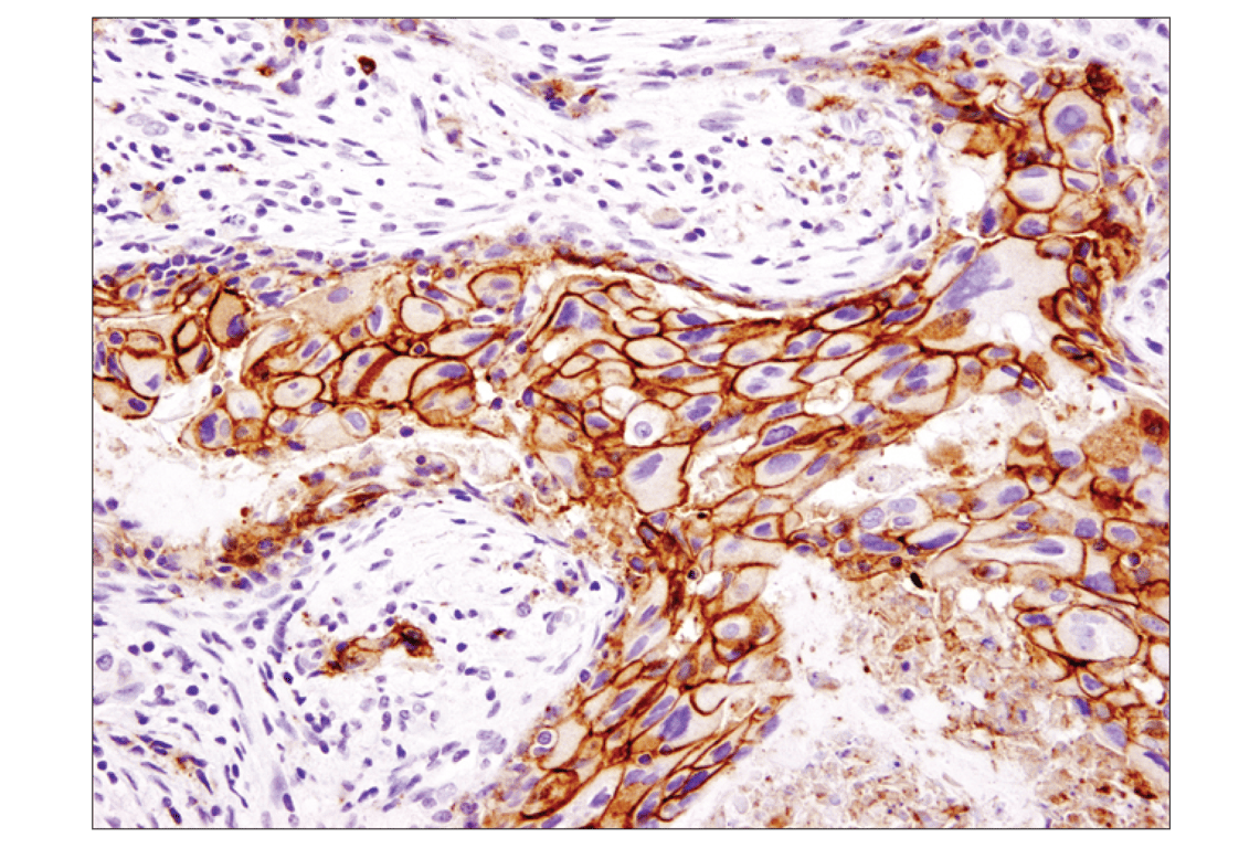 Immunohistochemistry Image 2: EpCAM (D9S3P) Rabbit Monoclonal Antibody (BSA and Azide Free)