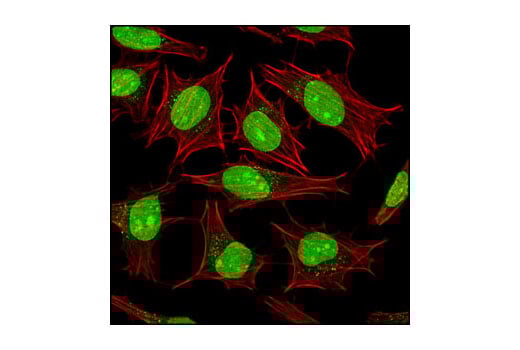 Immunofluorescence Image 1: SUMO-1 Antibody