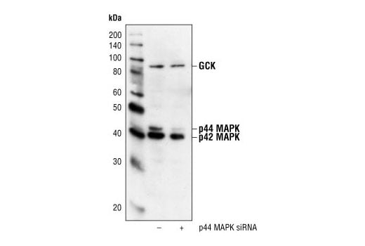 undefined Image 2: SignalSilence<sup>®</sup> p44 MAPK (Erk1) siRNA I