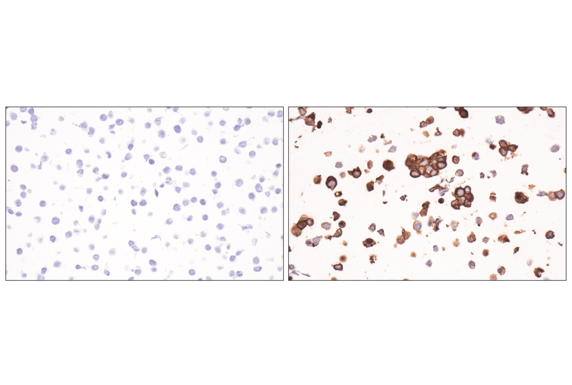 Immunohistochemistry Image 7: ESAM (F9D9P) Rabbit Monoclonal Antibody