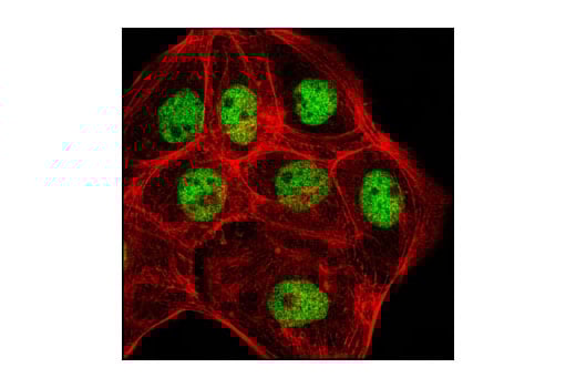 Immunofluorescence Image 1: MSK2 (D41A4) Rabbit Monoclonal Antibody