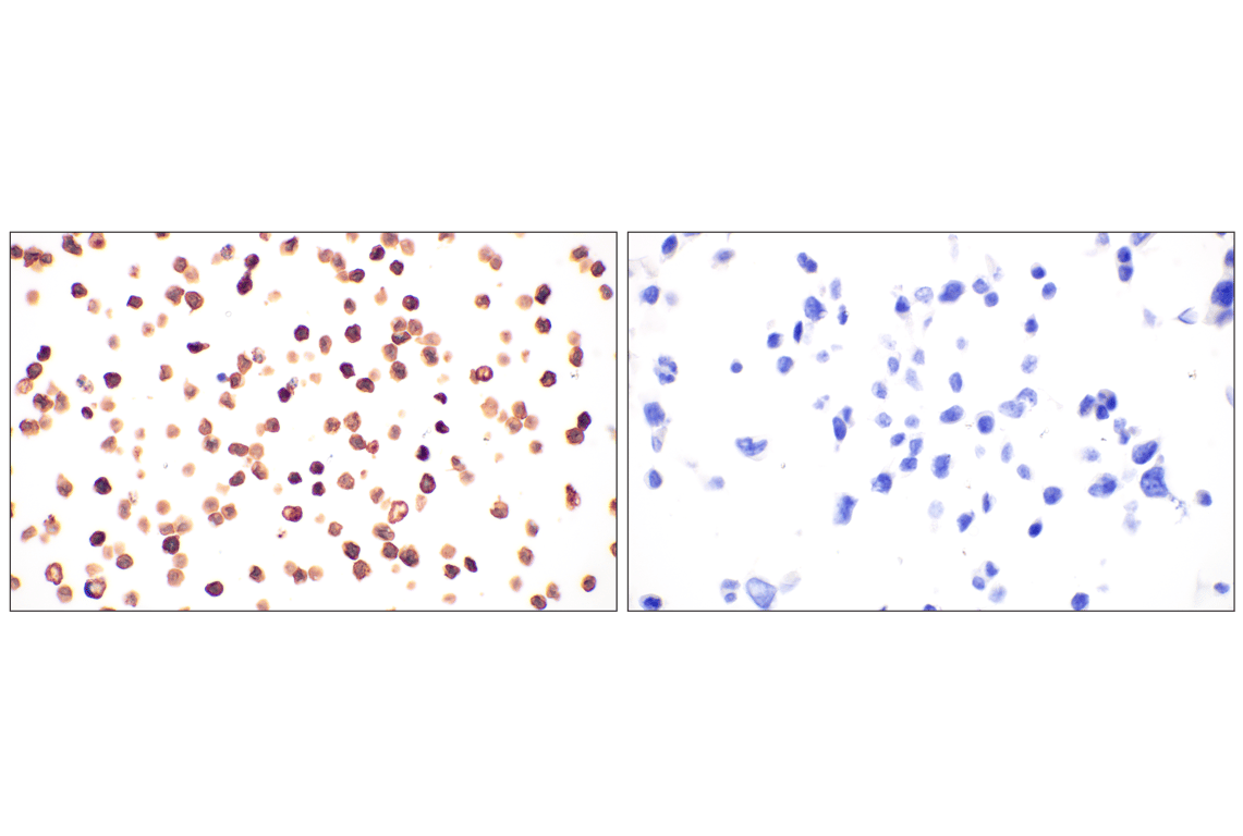 Immunohistochemistry Image 6: CD20 (E3N7O) Rabbit Monoclonal Antibody