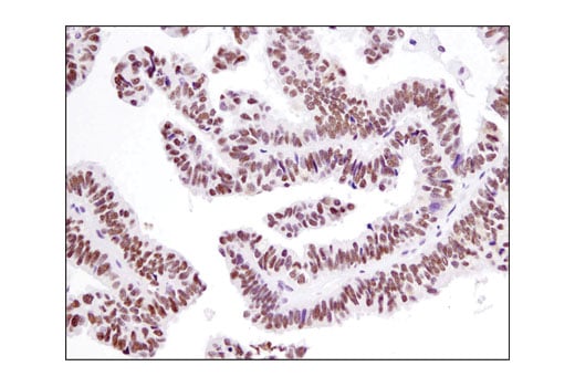 Immunohistochemistry Image 3: UTX (D3Q1I) Rabbit Monoclonal Antibody