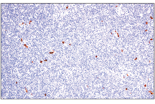Immunohistochemistry Image 1: XCR1 (D2F8T) Rabbit Monoclonal Antibody