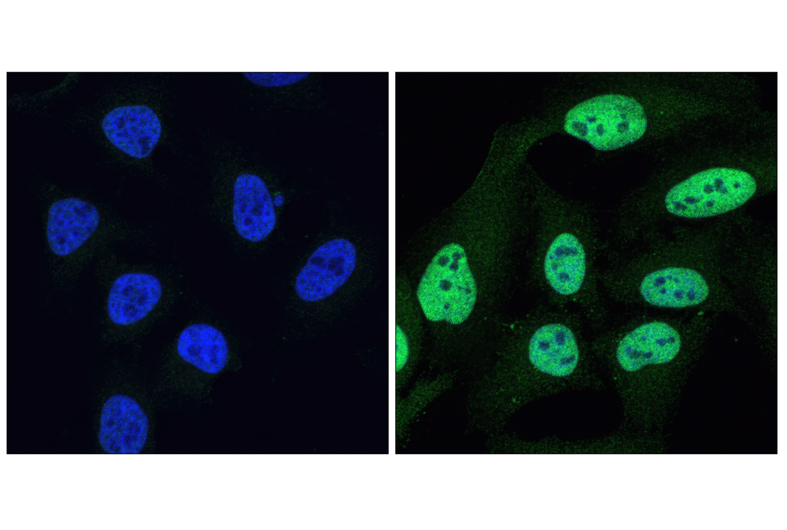 Immunofluorescence Image 1: Phospho-Stat1 (Tyr701) (58D6) Rabbit Monoclonal Antibody (BSA and Azide Free)