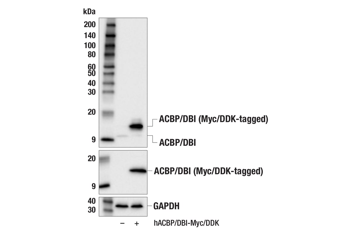 Western Blotting Image 2: ACBP/DBI (E4V8V) Rabbit Monoclonal Antibody
