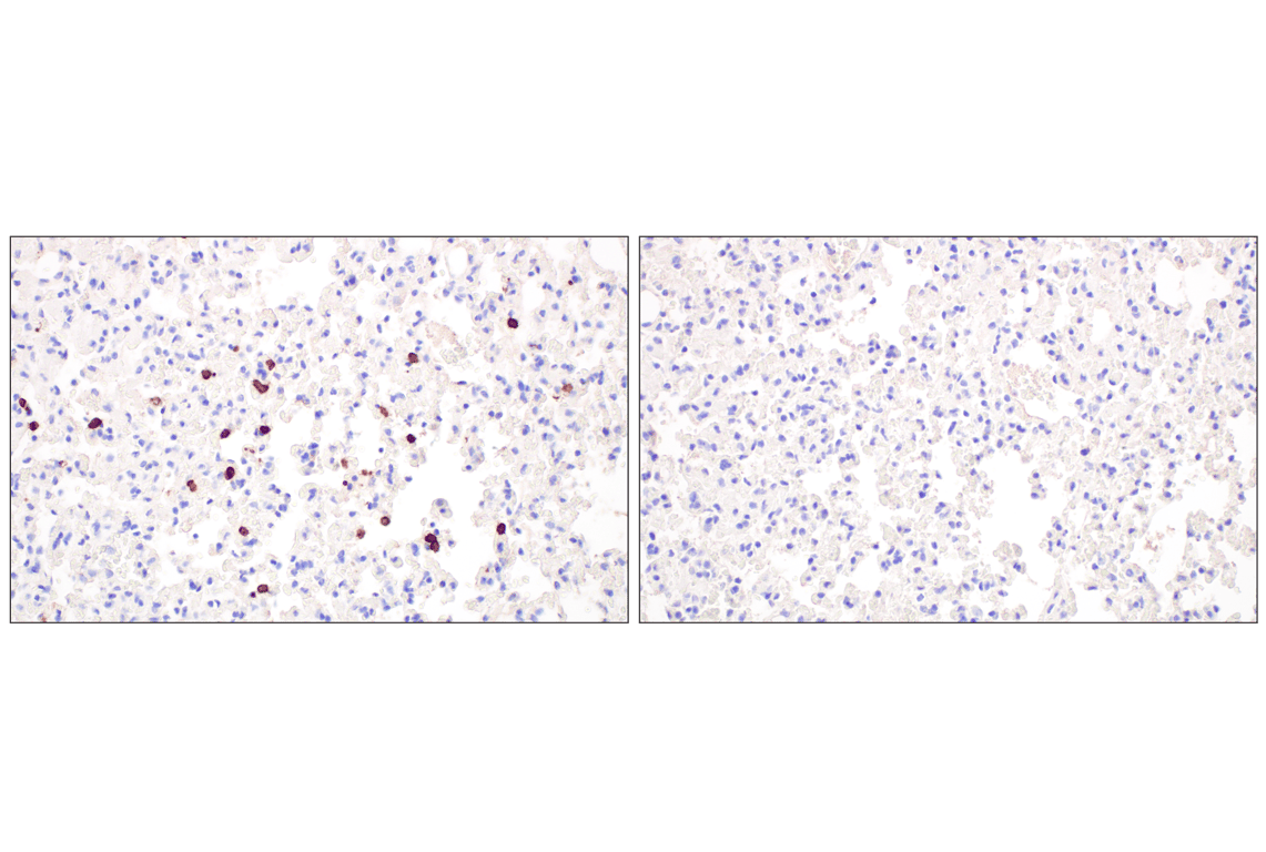Immunohistochemistry Image 5: CD20 (E3N7O) Rabbit Monoclonal Antibody