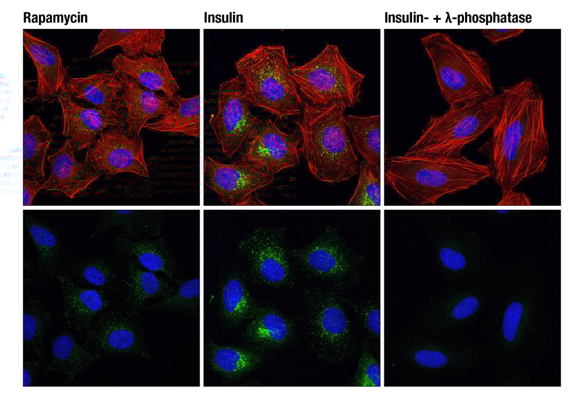 Phospho-mTOR (Ser2448) (D9C2) XP® Rabbit mAb | Cell