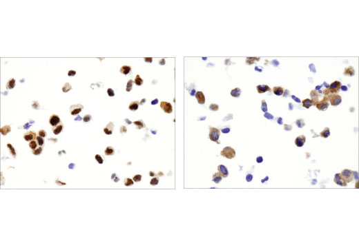 Immunohistochemistry Image 4: FoxO1 (D8T1S) Mouse Monoclonal Antibody
