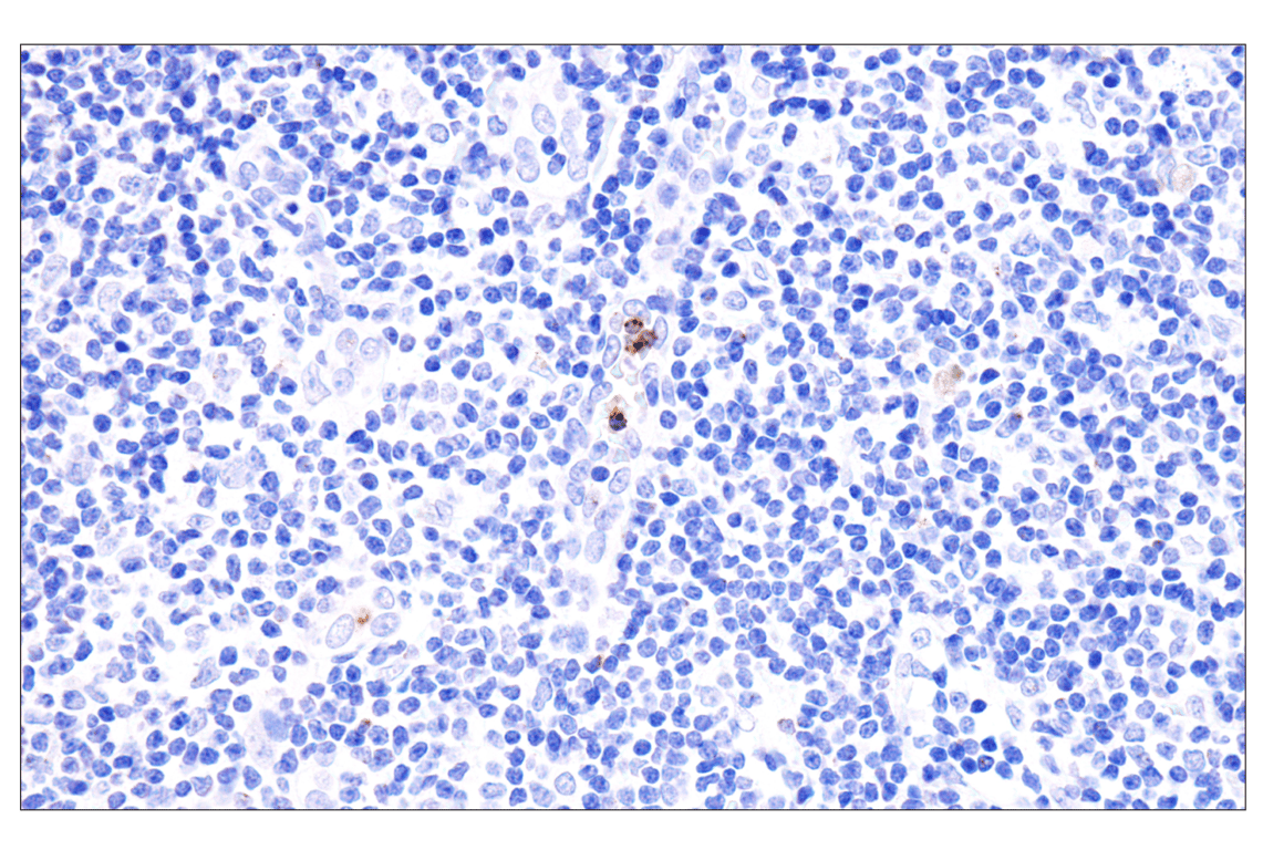 Immunohistochemistry Image 3: Perforin (IHC646) Mouse Monoclonal Antibody