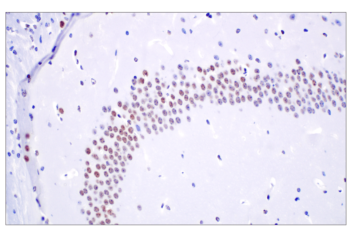 Immunohistochemistry Image 5: TCF4/ITF2 (E3X2Y) Rabbit Monoclonal Antibody