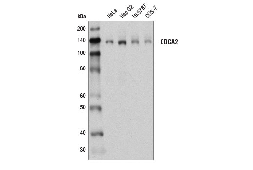 Western Blotting Image 1: CDCA2 (D7T4P) Rabbit mAb