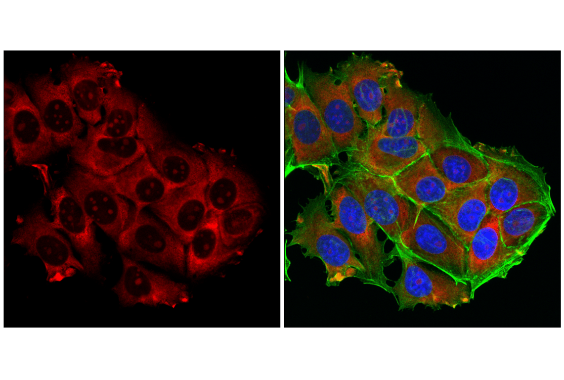 Immunofluorescence Image 1: S6 Ribosomal Protein (54D2) Mouse Monoclonal Antibody (Alexa Fluor<sup>®</sup> 700 Conjugate)