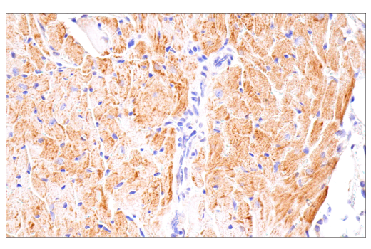 Immunohistochemistry Image 10: Cox2 (D5H5) Rabbit Monoclonal Antibody (BSA and Azide Free)