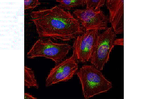undefined Image 9: Rab Family Antibody Sampler Kit
