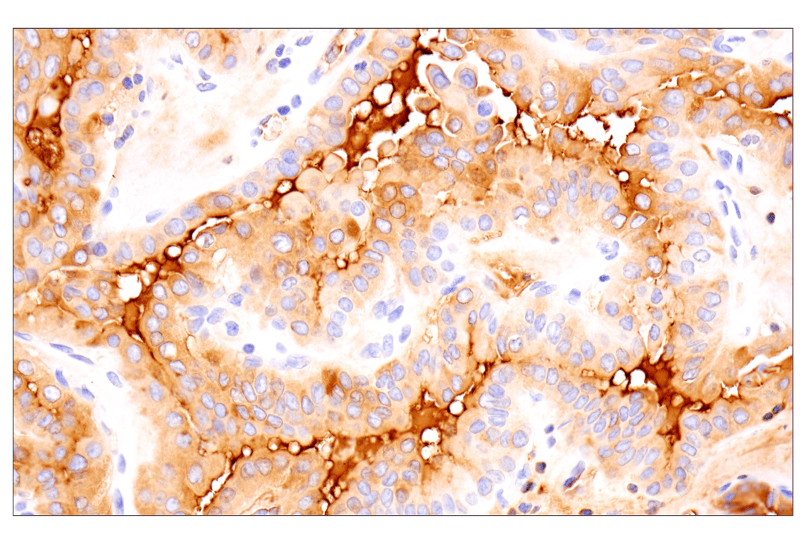 Immunohistochemistry Image 1: Thyroglobulin (F5O9B) Rabbit Monoclonal Antibody