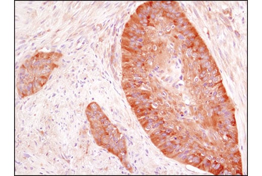 Immunohistochemistry Image 2: HDAC6 (D2E5) Rabbit Monoclonal Antibody