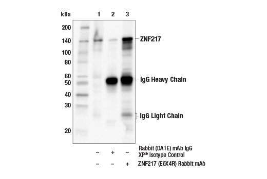 Immunoprecipitation Image 1: ZNF217 (E6X4R) Rabbit Monoclonal Antibody