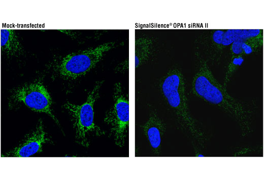 Immunofluorescence Image 1: OPA1 (D7C1A) Rabbit Monoclonal Antibody