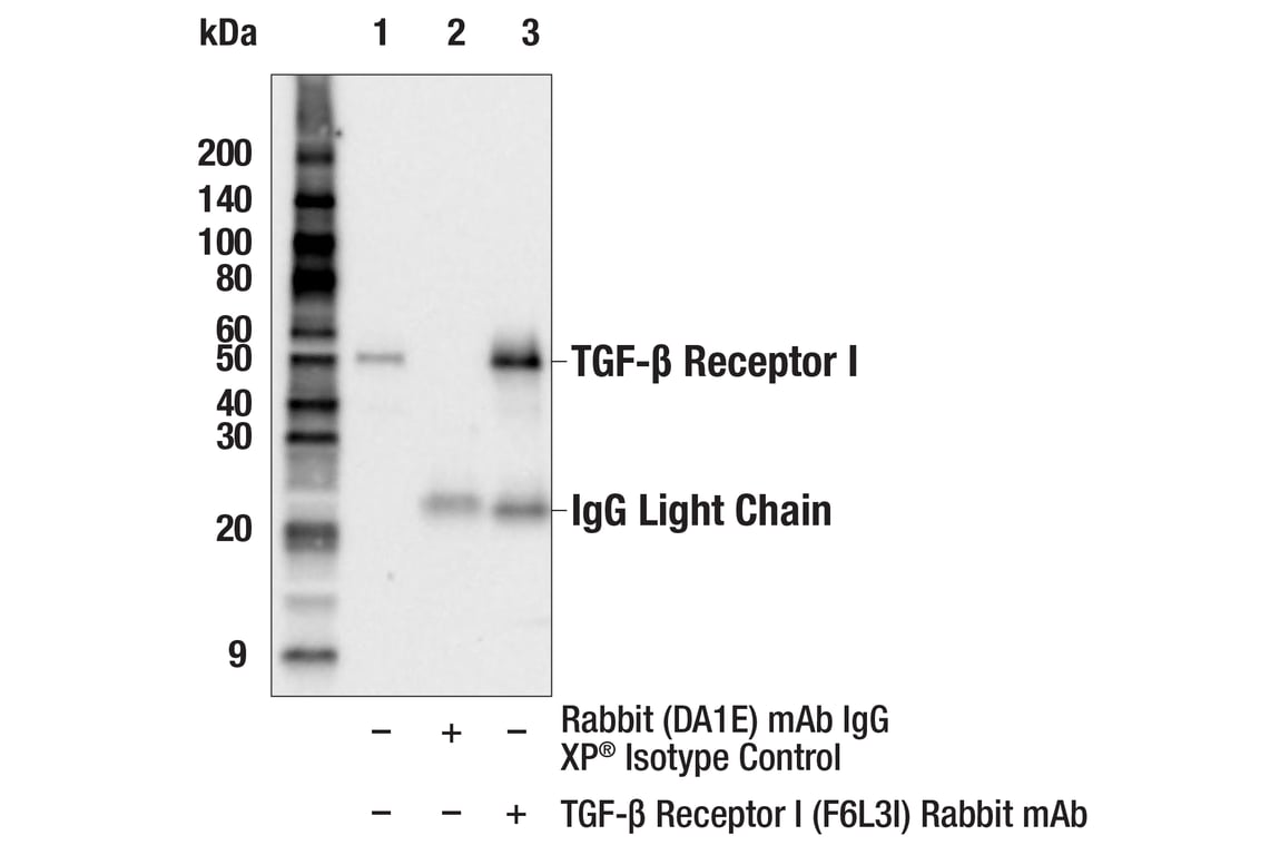 Immunoprecipitation Image 1: TGF-beta Receptor I (F6L3I) Rabbit Monoclonal Antibody