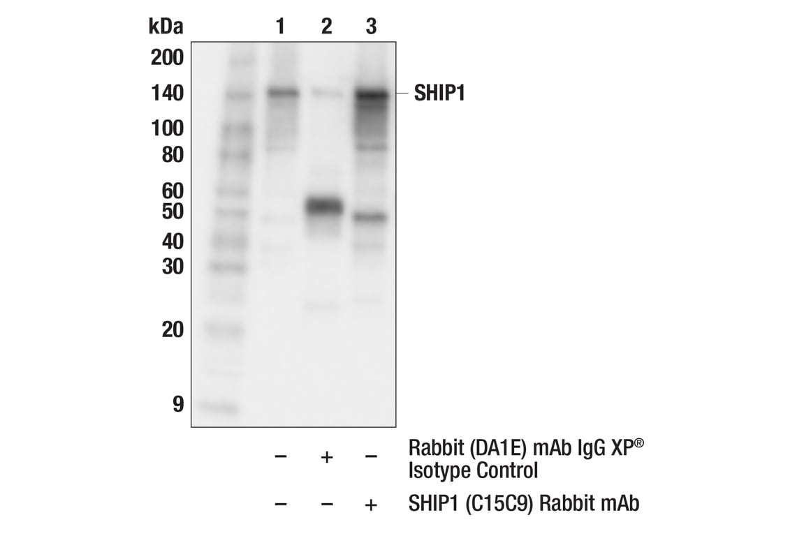 Immunoprecipitation Image 1: SHIP1 (C15C9) Rabbit Monoclonal Antibody