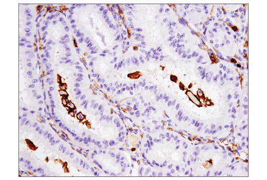 CD11b/ITGAM (D6X1N) Rabbit mAb | Cell Signaling Technology