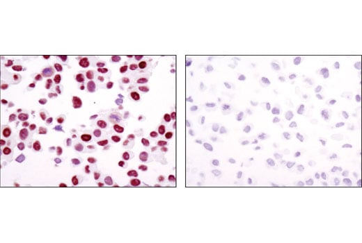 Immunohistochemistry Image 1: Androgen Receptor (D6F11) Rabbit Monoclonal Antibody