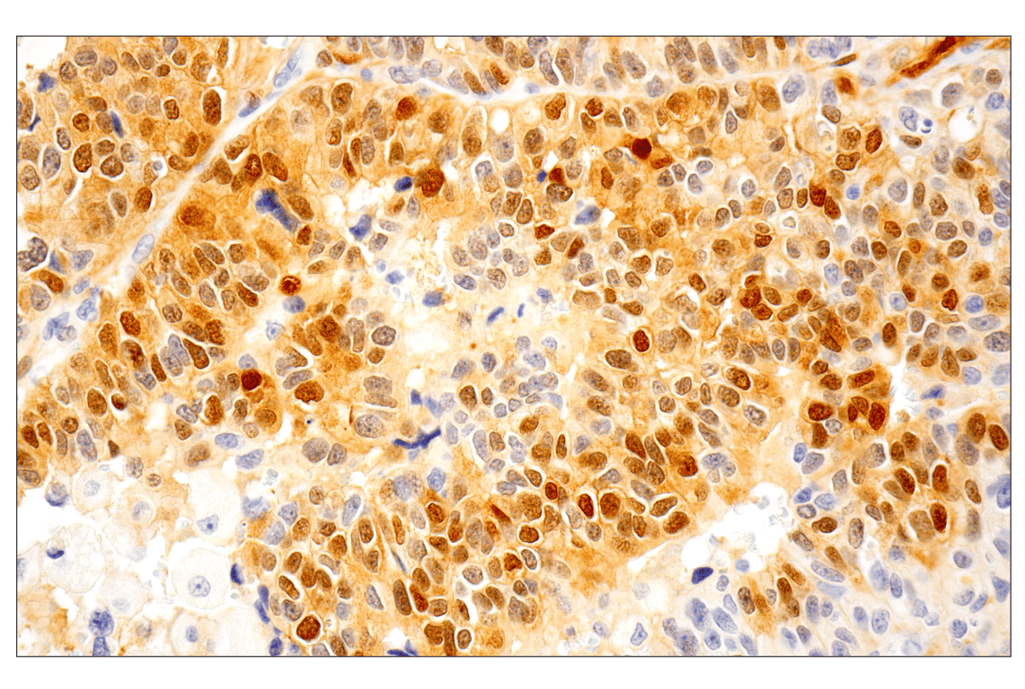 undefined Image 5: ALK Activation Antibody Sampler Kit
