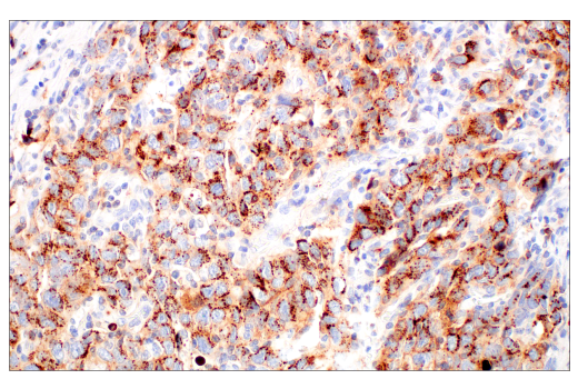 Immunohistochemistry Image 4: CD70 (E3Q1A) Rabbit Monoclonal Antibody (BSA and Azide Free)