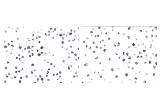Immunohistochemistry Image 2: CD40 Ligand (D5J9Y) Rabbit Monoclonal Antibody
