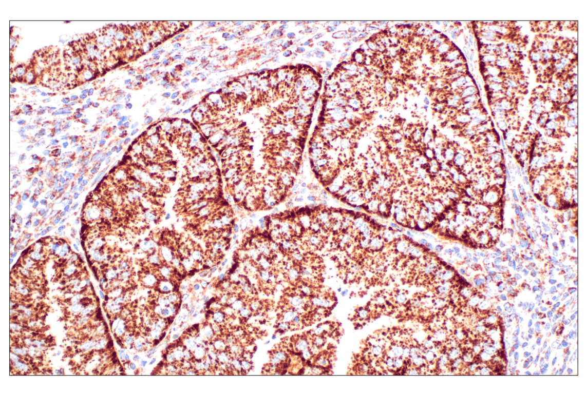 undefined Image 8: Organelle Localization IF Antibody Sampler Kit
