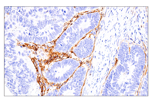 Immunohistochemistry Image 1: NCAM1 (CD56) (E7X9M) Rabbit Monoclonal Antibody
