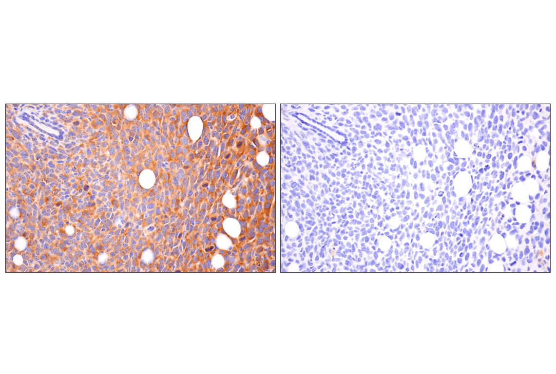 Immunohistochemistry Image 7: FAK (F7Z4C) Mouse Monoclonal Antibody