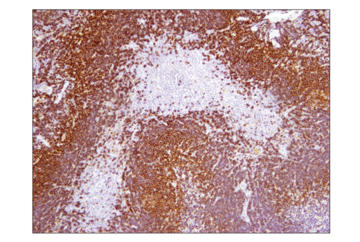 Immunohistochemistry Image 3: CD19 (Intracellular Domain) (D4V4B) Rabbit Monoclonal Antibody (BSA and Azide Free)