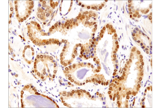 Immunohistochemistry Image 3: TFEB (D2O7D) Rabbit Monoclonal Antibody (BSA and Azide Free)