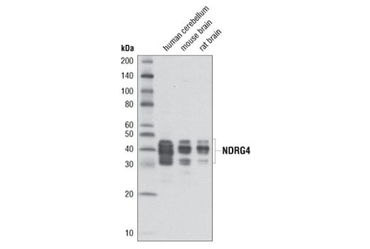 Western Blotting Image 1: NDRG4 (D4A6) Rabbit mAb