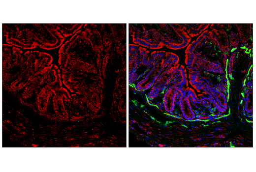 Immunofluorescence Image 2: FIS1 (E3K9O) Rabbit Monoclonal Antibody