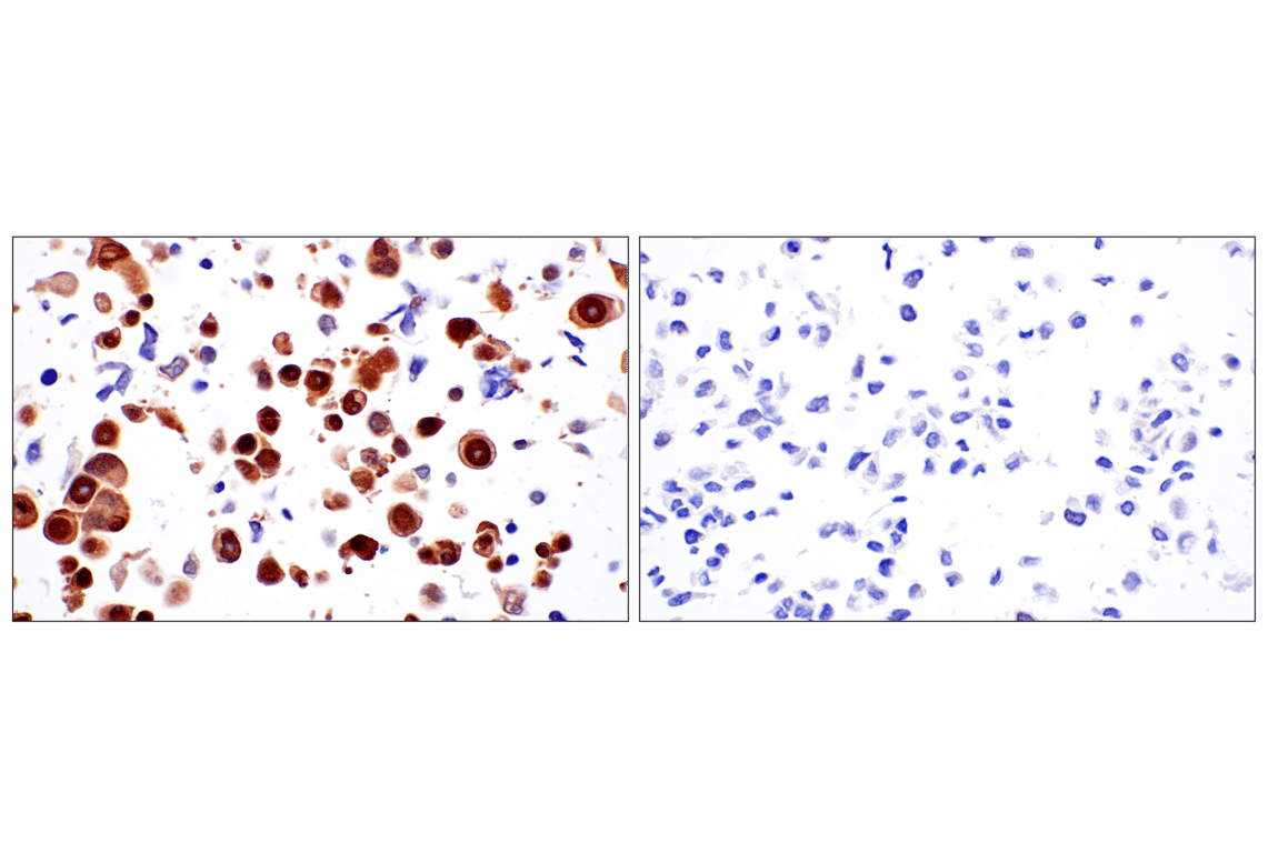 Immunohistochemistry Image 7: p16 INK4A (F2T7H) Rabbit Monoclonal Antibody