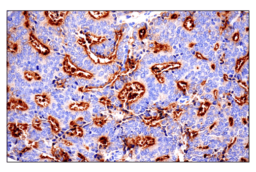 Immunohistochemistry Image 8: CD10/Neprilysin (E5P7S) Rabbit Monoclonal Antibody (BSA and Azide Free)
