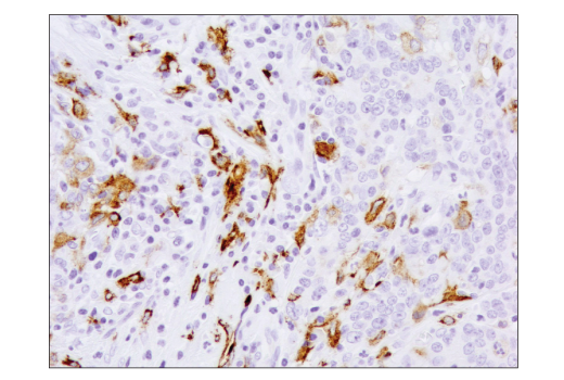Immunohistochemistry Image 3: CD206/MRC1 (E2L9N) Rabbit Monoclonal Antibody (BSA and Azide Free)