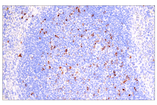 Immunohistochemistry Image 7: CTLA-4 (E2V1Z) Rabbit Monoclonal Antibody (BSA and Azide Free)