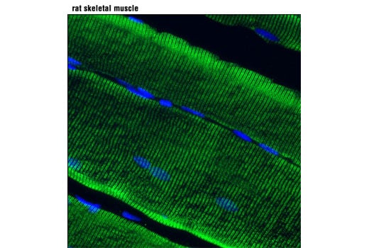 Immunofluorescence Image 1: RyR1 (D4E1) Rabbit Monoclonal Antibody