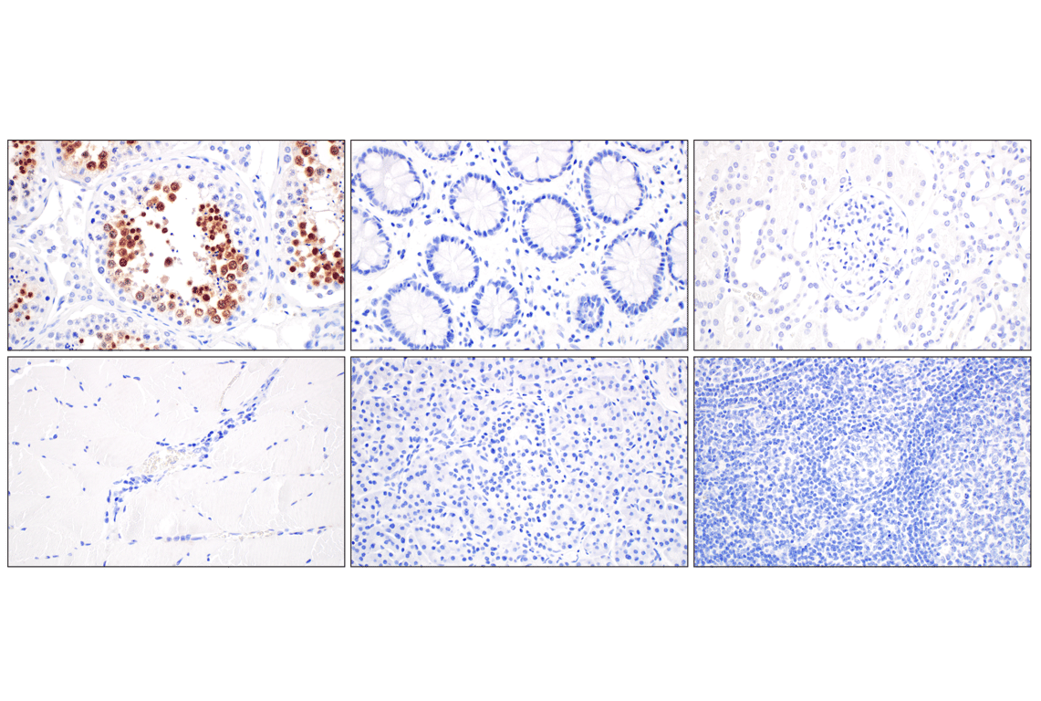 Miwi (D92B7) XP® Rabbit mAb | Cell Signaling Technology