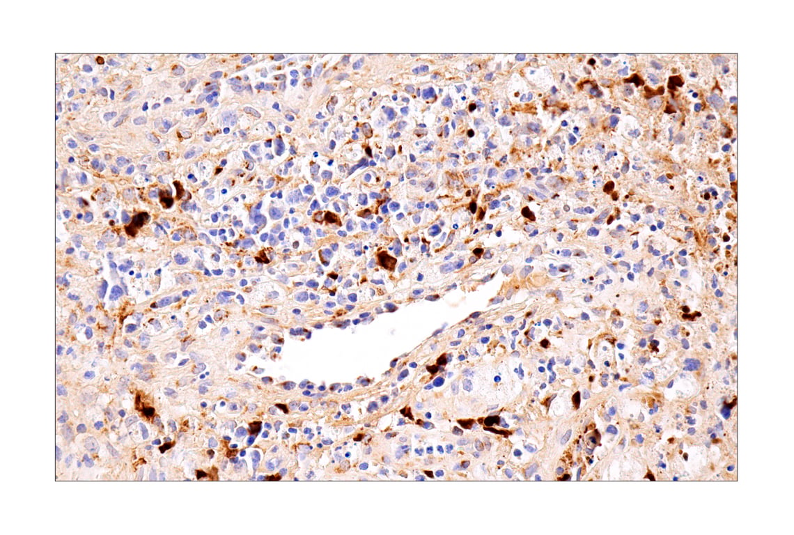 Immunohistochemistry Image 2: CXCL9/MIG (E6Z5W) Rabbit Monoclonal Antibody