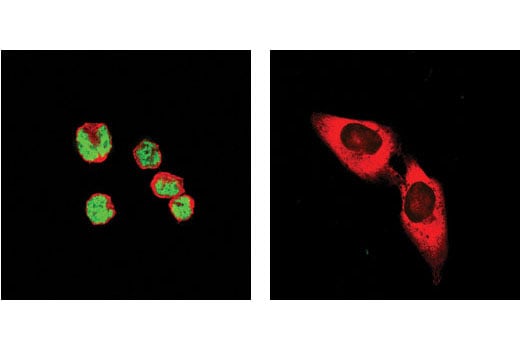 Immunofluorescence Image 1: GATA-1 (D52H6) XP<sup>®</sup> Rabbit mAb (BSA and Azide Free)