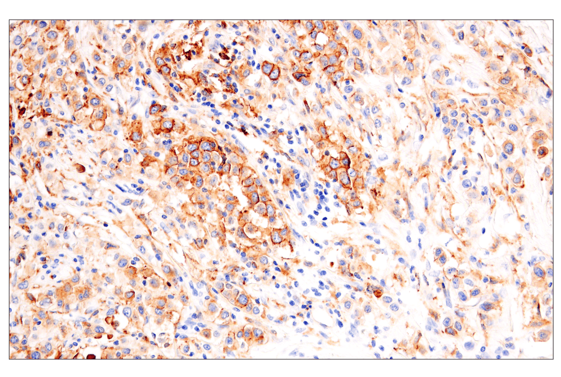 Immunohistochemistry Image 1: HLA-DRA (E9R2Q) Rabbit Monoclonal Antibody (BSA and Azide Free)