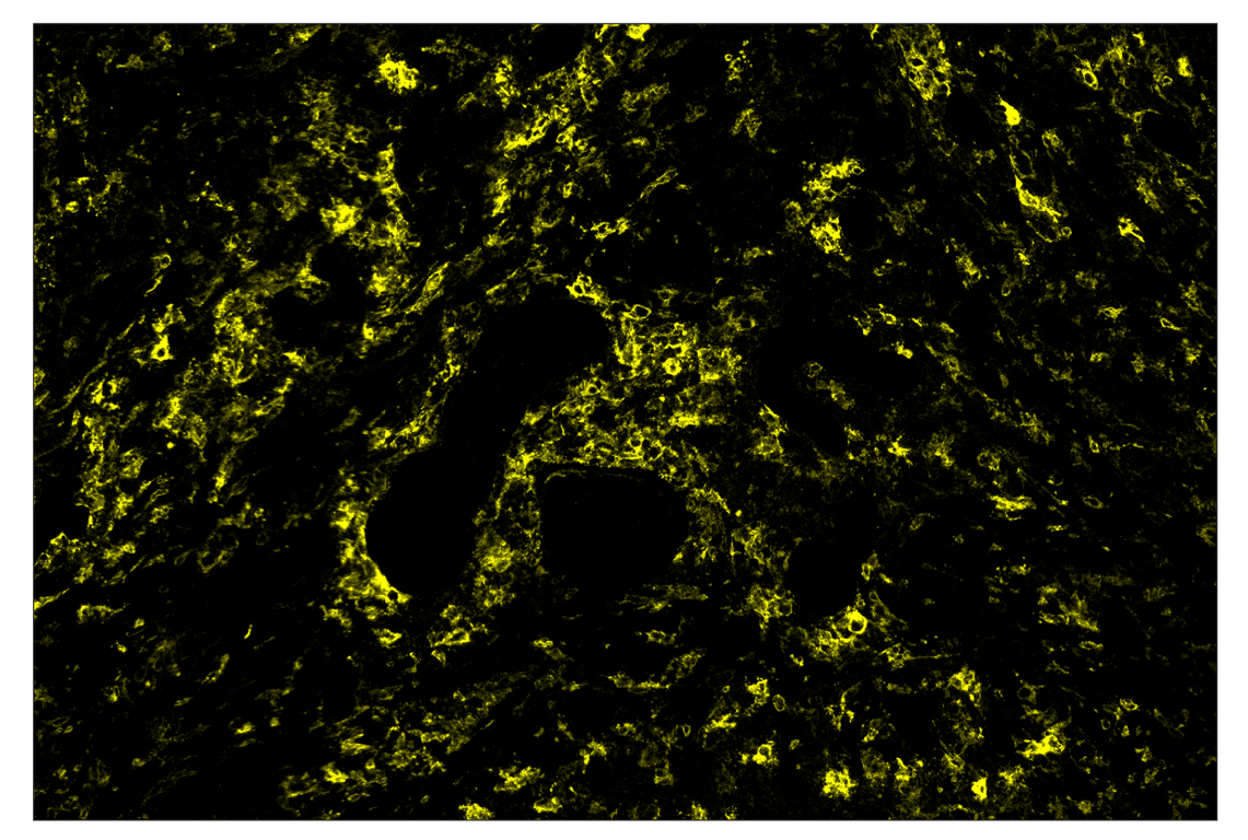 Immunohistochemistry Image 3: TMEM119 (E3E4T) & CO-0130-488 SignalStar<sup>™</sup> Oligo-Antibody Pair