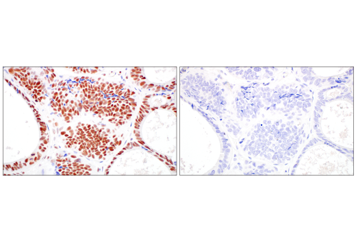 Immunohistochemistry Image 13: TIF1 alpha/TRIM24 (E9T3N) Rabbit Monoclonal Antibody