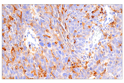 Immunohistochemistry Image 3: GM-CSF Receptor alpha (E8Z3S) Rabbit Monoclonal Antibody (BSA and Azide Free)