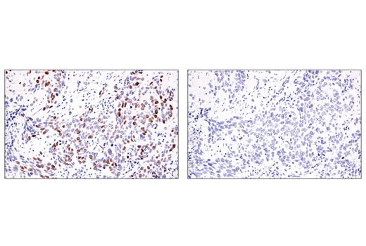 Immunohistochemistry Image 2: ATAD2 (E8Y2K) Rabbit Monoclonal Antibody